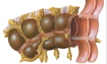 507 Makroskopie Colon.jpg