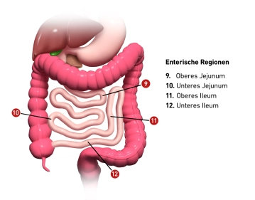 Sugarbaker Index (Peritoneal Cancer Index) 2