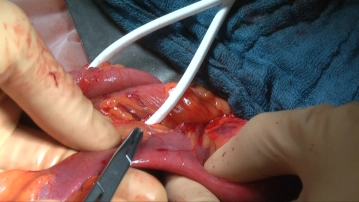 Preparation of the Intestinal Wall