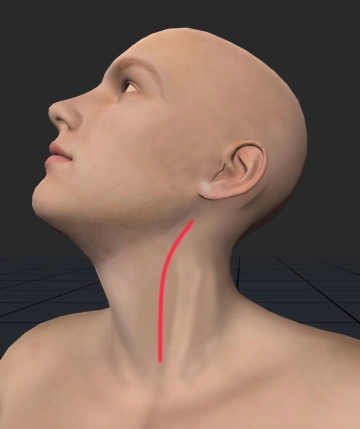 Left cervical access