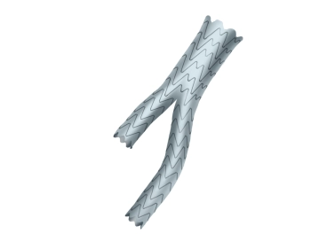 Preparation of the main graft body
