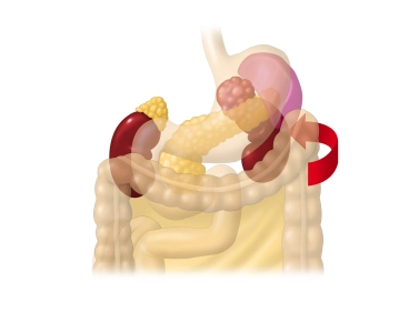 Opening of the prerenal space