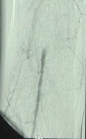 PM 311-3