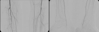 PM 322-3