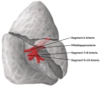 Projekt_412_Arterie
