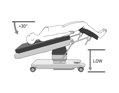 diagnostic laparoscopy for adhesion zone, lavage cytology, biopsy sampling, second look operation