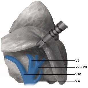 412-Anatomie-Vene