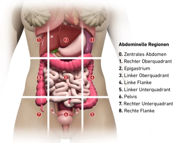 Sugarbaker Index (Peritoneal Cancer Index) 1