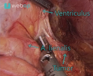 Eingang zur Nebenniere