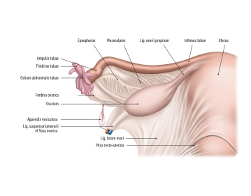 Adnexektomie und parametraner Halteapparat rechts 2
