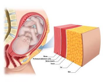 Haut und subkutanes Gewebe