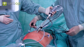 Trokarplatzierung; Befunderhebung