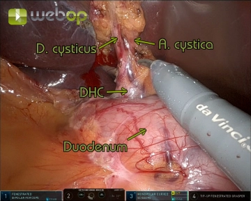 Präparation des Callot´schen Dreiecks 1
