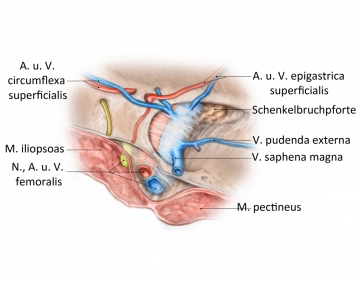 Topographische Anatomie der Schenkelbruchpforte von außen