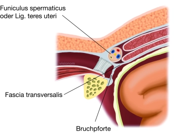 Die Schenkelbruchpforte im Transversalschnitt