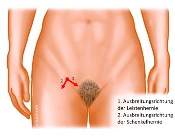 Präoperative Diagnostik