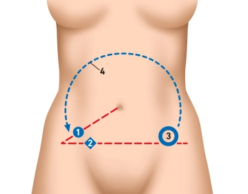 Präoperative Diagnostik