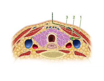 Eingehen in die Schilddrüsenloge am Vorderrand des M. sternocleidomastoideus