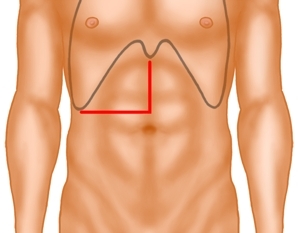 Laparotomie und Exploration der Abdominalhöhle