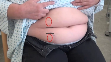 Spezielle Vorbereitung