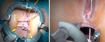 Spezielle Instrumentarien und Haltesysteme