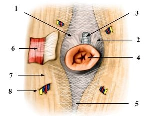 Spezielle Anatomie der Nabelregion