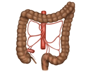 Anatomie Kolektomie Mit Ileorektostomie Laparoskopisch