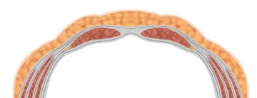 Faszien und Peritoneum