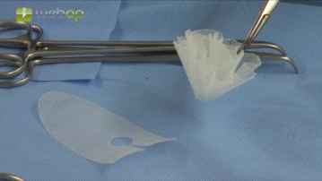  Spezielle Instrumentarien und Haltesysteme