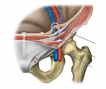 Chirurgisch relevante Anatomie