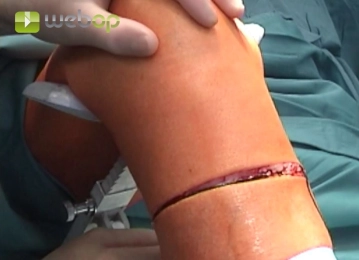 Spezielle Instrumentarien und Haltesysteme