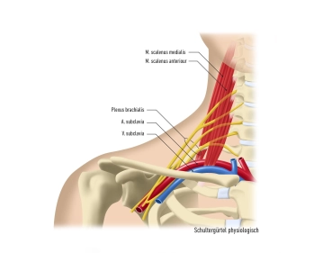 Anatomie und Pathogenese des TOS