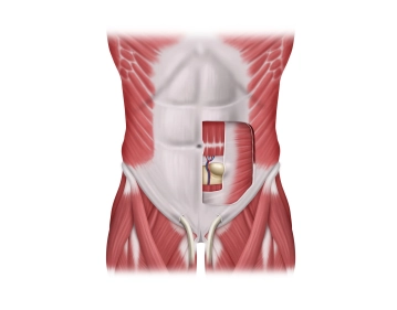 Anatomie der Spieghel`schen Hernie