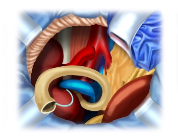 Darstellung des Blasendaches