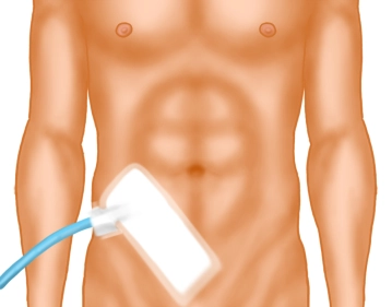 Hautverschluss und Verband