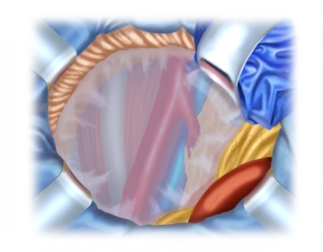 Darstellung des Retroperitoneums