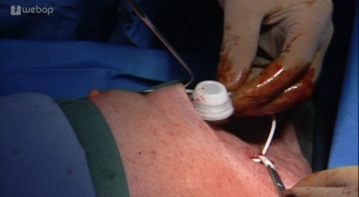  Präparation der Porttasche