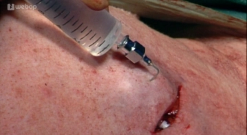 Abschließende Funktionskontrolle