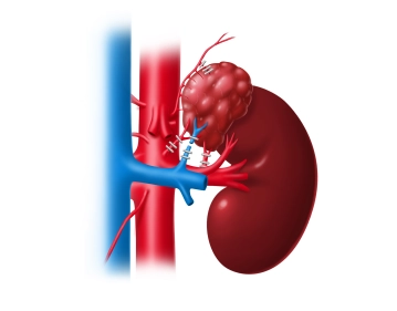Unterbrechung der arteriellen Versorgung