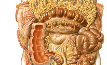 Anatomie Hemikolektomie Rechts Laparoskopisch Assistiert