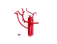 168_LAV_02_e_Leberarterie