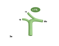 40_LAV_03_e_Gallenwege