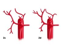 84_LAV_02_c_d_Leberarterie