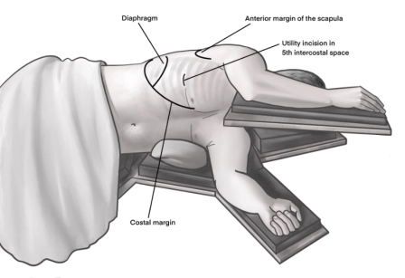 401_Liegender_Patient